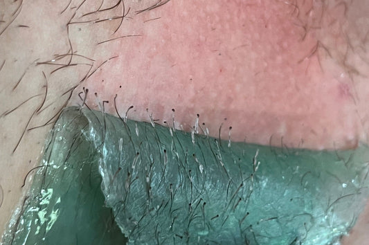 Vaksācijas strēmele izrauj matiņus ar visu sakni